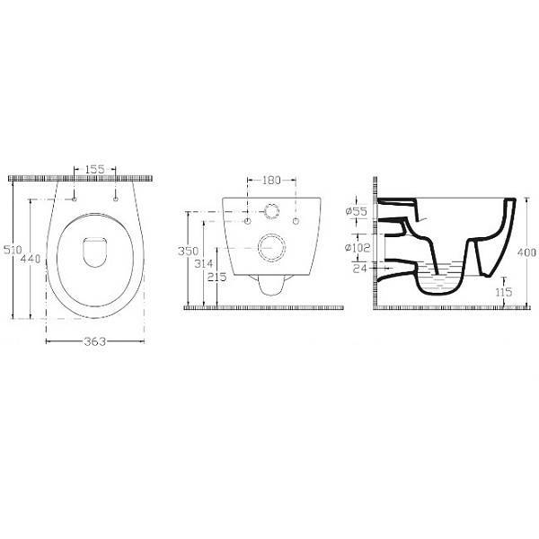 Унитаз подвесной безободковый Allen Brau Fantasy с гигиеническим душем 51x36.3 см 4.11HC1.20