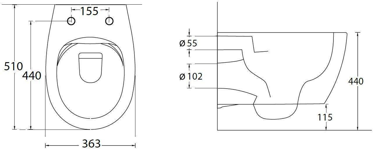 Унитаз подвесной с инсталляцией Allen Brau Fantasy 36.3x51x36 см белый 00316504